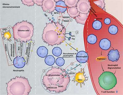Neutrophils: New Critical Regulators of Glioma